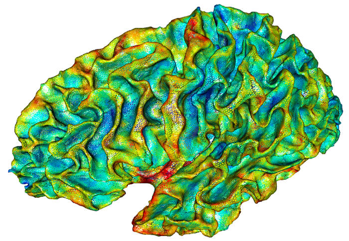 Figure 2: Cortical thickness data visualized on a brain mesh in interactive view.