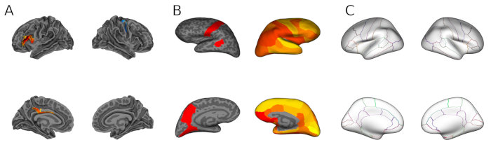 Figure 5: Different backgrounds and color layers. A Clusters on white fsaverage surface with sulc background. B Region-wise p-values with curv background, inflated surface. C Color layer displaying outlines of aparc atlas regions in the respective colors.