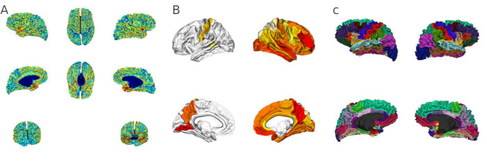 Figure 3: Various fsbrain visualizations. A Native space morphometry data. B Results of a region-based analysis. C An atlas.